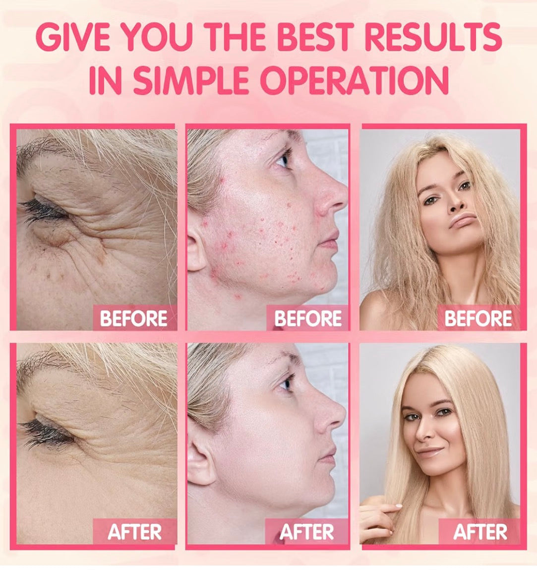 High Frequency Facial Wand